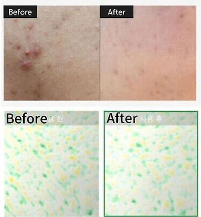 VT Cosmetics Reedle Shot 100 Αντιγηραντικό Essence Προσώπου με Centella Asiatica & Νιασιναμίδη 50ml