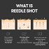 Vt Cosmetics Reedle Shot 300 50ml Εντατικός Ενισχυτής Ενδυνάμωσης
