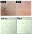VT Cosmetics Reedle Shot 100 Αντιγηραντικό Essence Προσώπου με Centella Asiatica & Νιασιναμίδη 50ml
